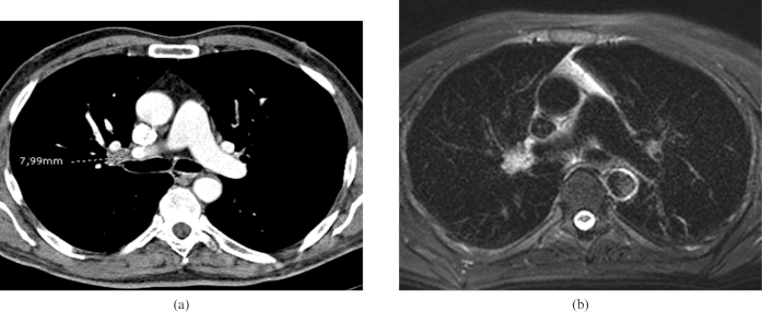 MRI (Magnetic Resonance Imaging) Images